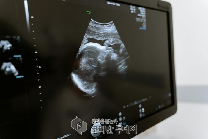 “육아휴직이 눈치의 대상?”…임신 후 해고 압박, 여전히 현실인 일터