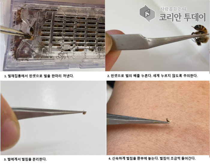 벌침요법의 놀라운 효능, 우리 몸이 바뀐다