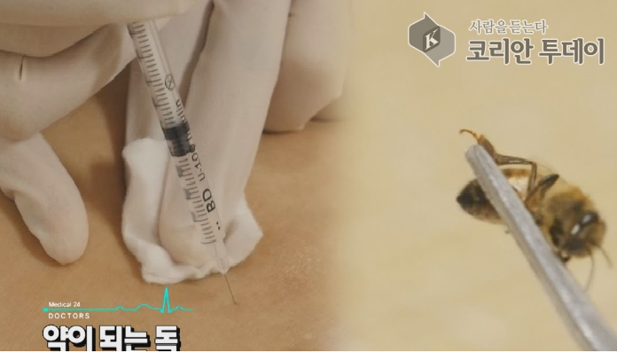 [벌침요법_08] 벌침요법으로 스트레스 해소? 몸과 마음의 균형을 찾아서